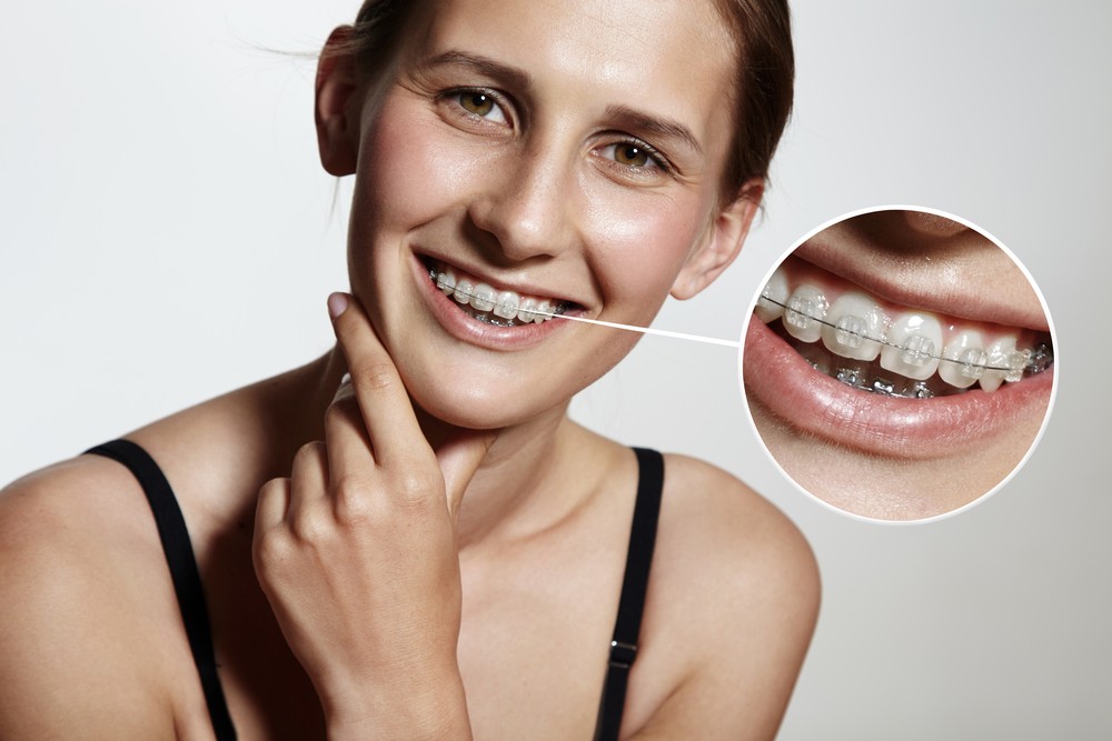 aparat dentar bucuresti