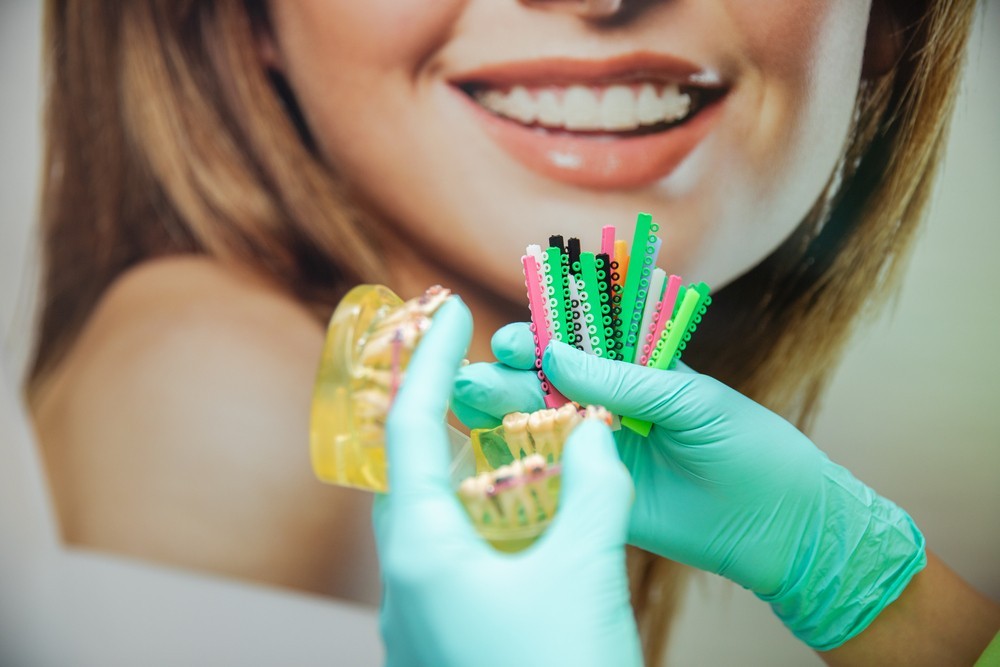 aparat dentar bucuresti