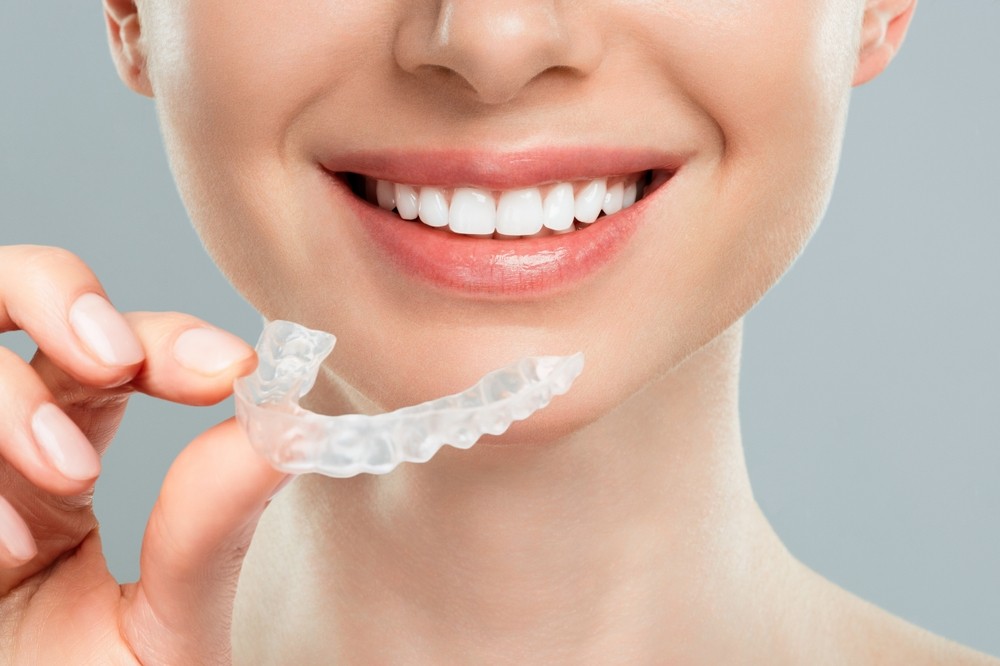 aparat dentar bucuresti
