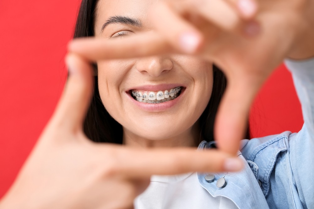 aparat dentar bucuresti