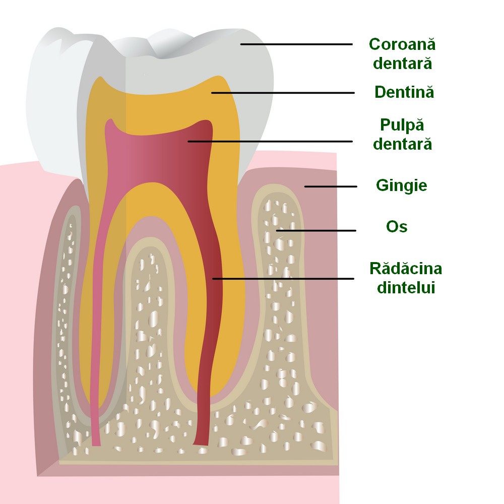 implant dentar bucuresti, implant dentar orto care, implant dentar vitan, implant dentar, orto care