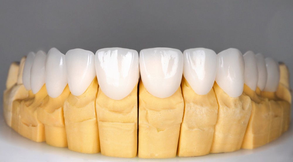 coroana dentara zirconiu, coroana dentara zirconiu calea vitan, coroana dentara zirconiu sector 3