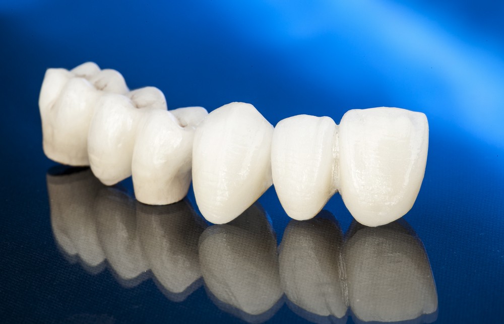 lucrari dentare zirconiu, lucrari dentare zirconiu calea vitan, protetica dentara calea vitan