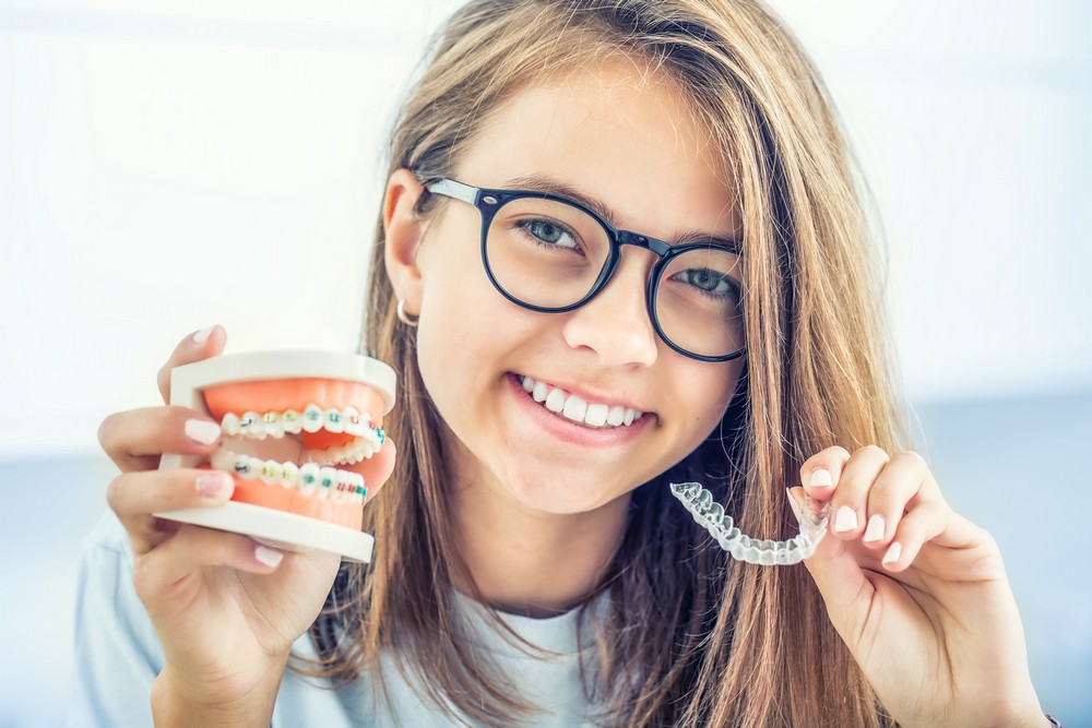 aparat dentar lingual bucuresti, aparat dentar bucuresti, aparat dentar metalic bucuresti